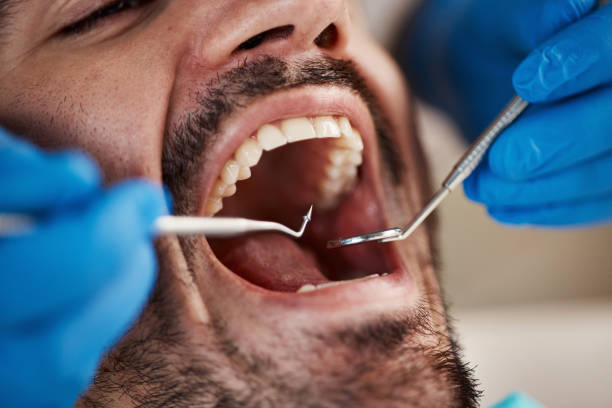 Emergency Dental Services in Springdale, OH